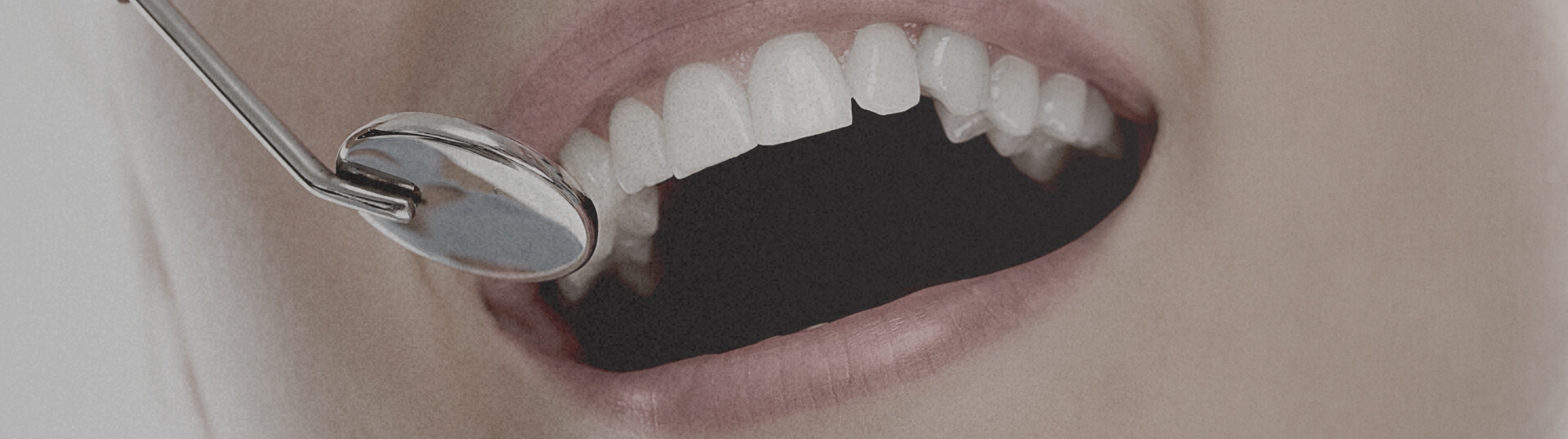 dental-implants-services-poster